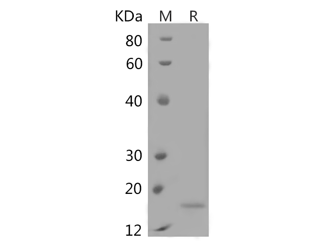 Recombinant Human Interferon α-1/IFNA1 Protein (His Tag) - 1