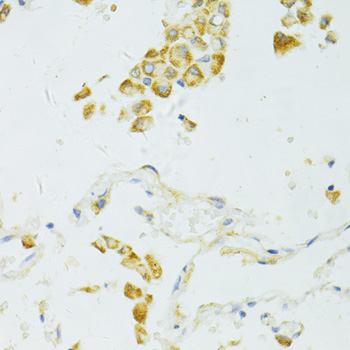 SIRT2 Polyclonal Antibody - 2