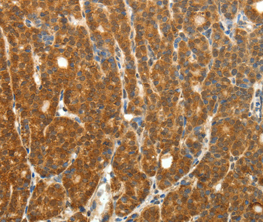 PTCH1 Polyclonal Antibody - 3