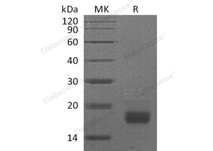 Recombinant Mouse Interferon γ/IFNG Protein (Human Cells) - small - 1