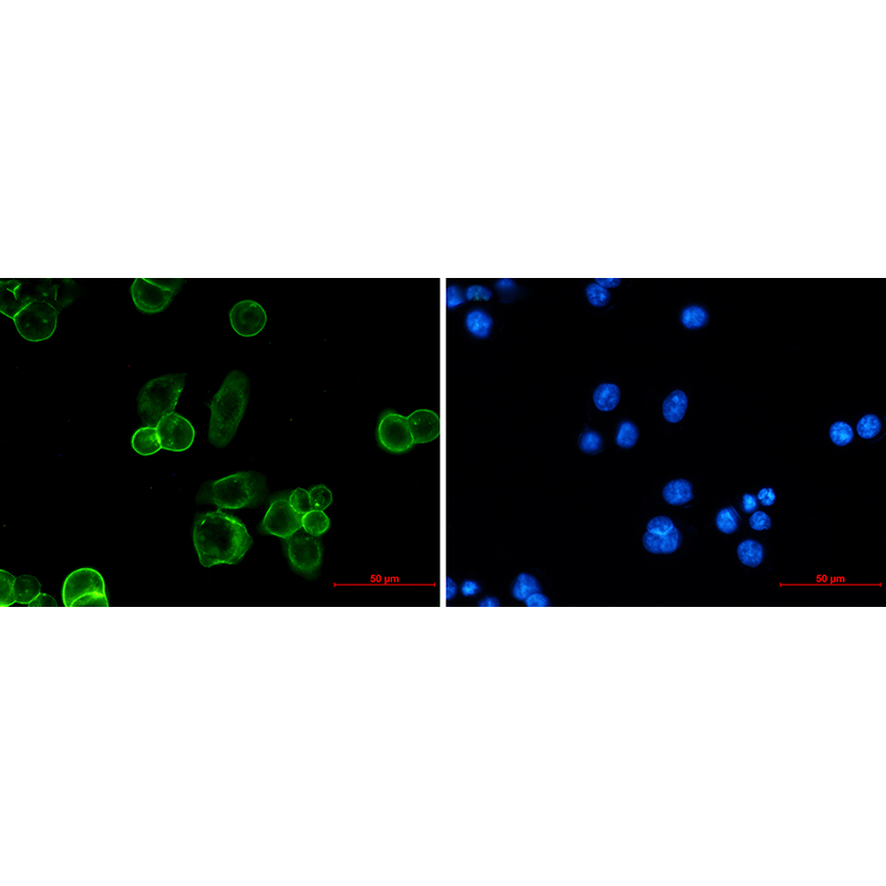 Recombinant EpCAM Monoclonal Antibody - 3