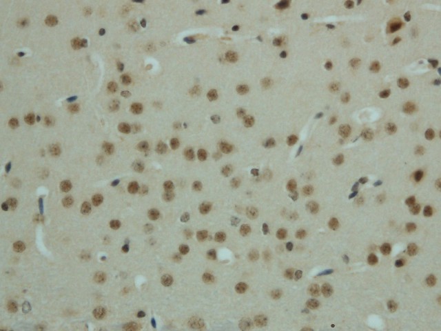 Phospho-AMPK alpha1/2 (Thr183/172) Polyclonal Antibody - 2