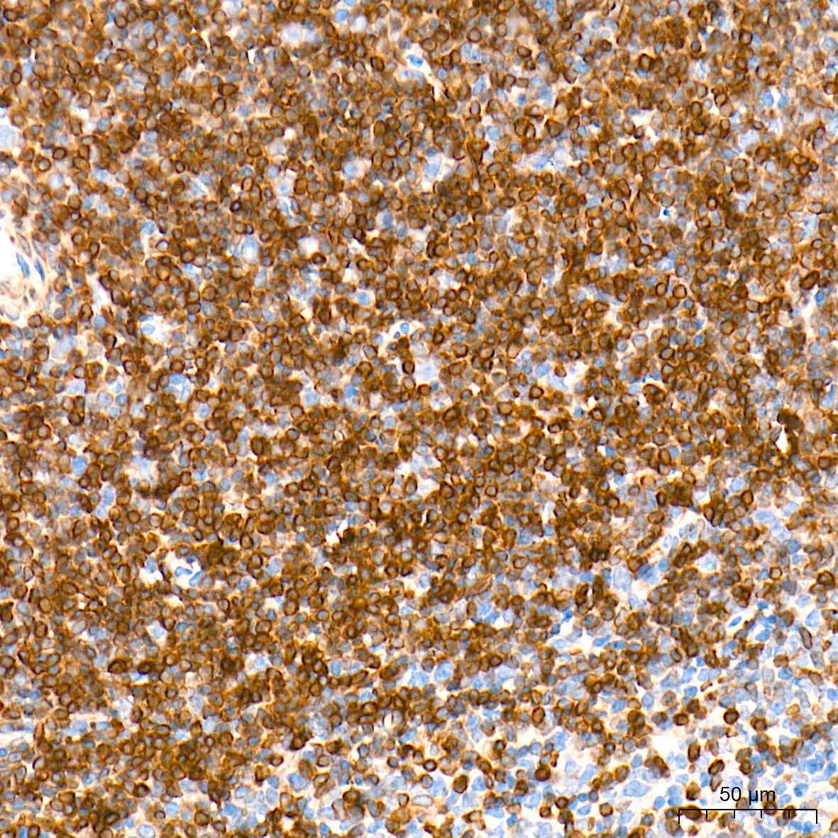 Bcl-2 Polyclonal Antibody - small - 6