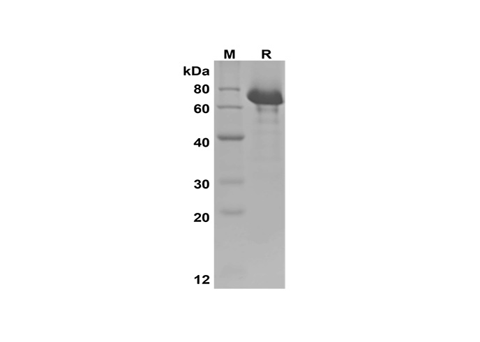 Recombinant Human IGF-1/HSA Fusion Protein(His Tag) - 1