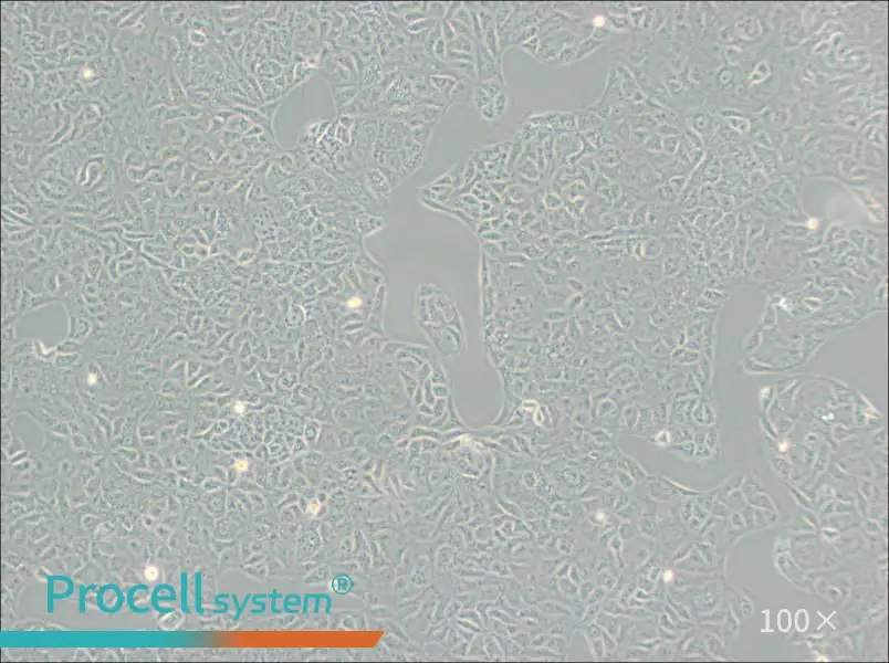 VERO C1008 [Vero E6] Cell Complete Medium - 2