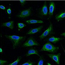 AQP4 Monoclonal Antibody - 3