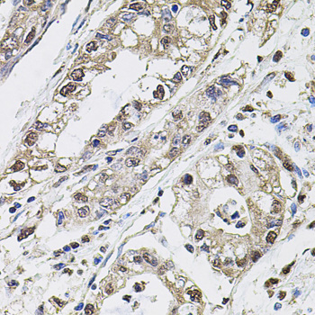 CA9 Polyclonal Antibody - 3