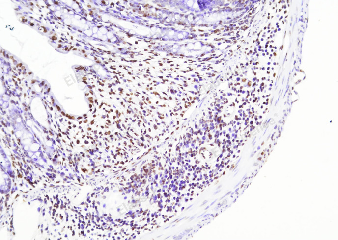 TUNEL In Situ Apoptosis Kit (HRP-DAB Method) - 1