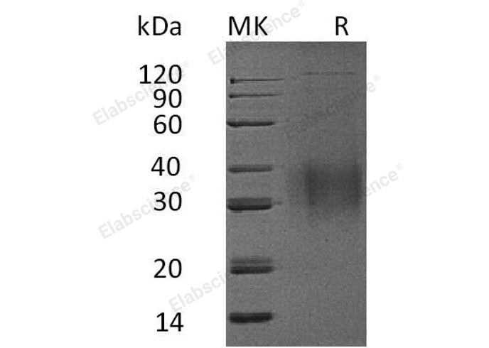 Recombinant Mouse Interleukin-9/IL-9 Protein (His Tag) - 1