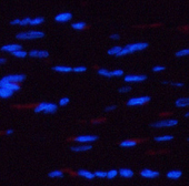 Phospho-AMPK alpha1/2 (Thr183/172) Polyclonal Antibody - 3