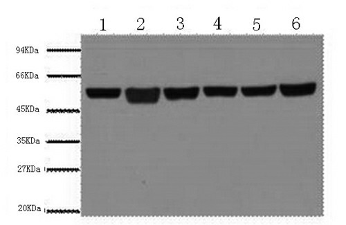 beta Tubulin Monoclonal Antibody - 1