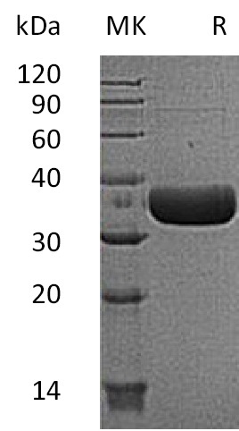 Recombinant Mouse MCPT6/Mast Cell Protease-6 Protein (His Tag) - 1