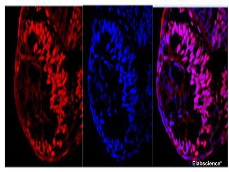 Ki67 Polyclonal Antibody - 1