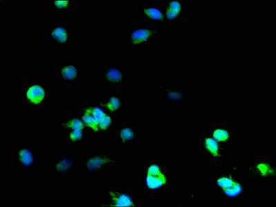 Immunofluorescence(IF) - SOD1 Antibody