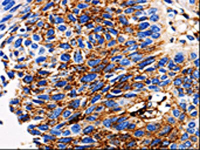 Immunohistochemistry(IHC) - ADAMTS5 Antibody