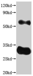 CSB-MP005498HU(A5)-WB2