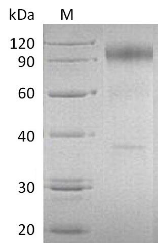 CSB-AP004371HU SDS-page