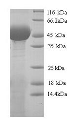SDS-PAGE - Recombinant Chamaecyparis obtusa Pectate lyase 1