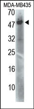The PDK4 Antibody (Cat. No. 200116) is used in Western blot to detect PDK4 in MDA-MB-435 cell lysate.