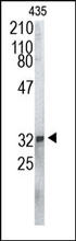 The 20S Proteasome Antibody is used in Western blot to detect the 20S proteasome subunit in MDA-MB-435 cell lysate.