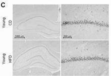 Adiponectin staining in rat brain. Paraformaldehyde-fixed paraffin-embedded brain tissues from high fat diet fed rats (HFD) vs. control diet (CD), are stained with Adiponectin Antibody (Cat. No. 250458) used at a 1:500 dilution (data from Pancani T et al. 2013).