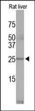 Adiponectin Antibody (Cat. No. 250458) is used in Western blot at a 1:200 dilution to detect adiponectin in a rat liver lysate.