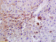 Insulin receptor staining in rat liver. Formalin-fixed paraffin-embedded rat liver tissue is stained with Insulin Receptor Antibody (Cat. No. 250721) used at 1:200 dilution.