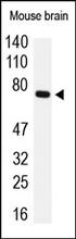The Tau Antibody (Cat. No. 251800) is used in Western blot to detect Tau in mouse brain lysates.