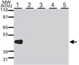 Western Blot (Cell lysate)