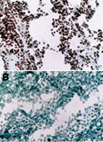 Immunohistochemistry (Frozen sections)