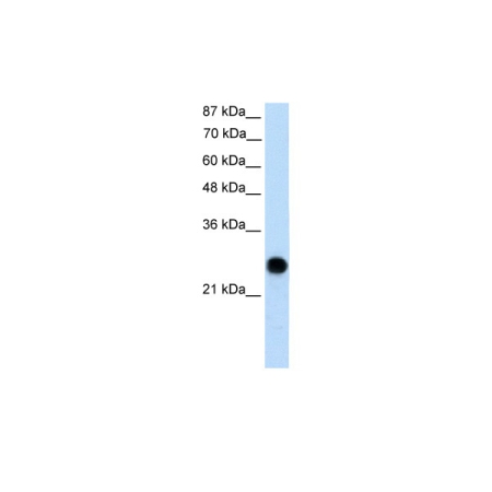 Human 293T