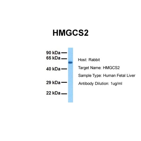 Human Fetal Liver