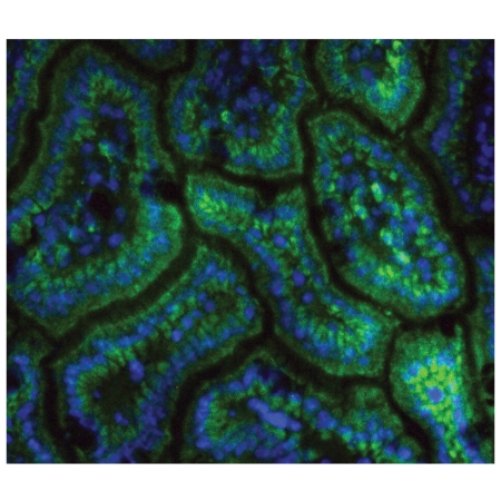 BALB/c mouse intestine sections
