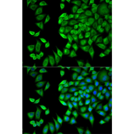 HeLa Cells,Multiple Cell Lines