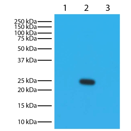 Mouse IgG1k, Mouse IgG2al, Mouse IgG2bk