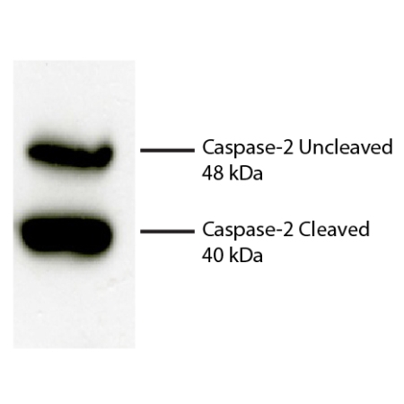 Total cell lysates from Jurkat cells