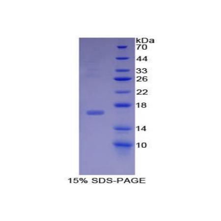 SDS-PAGE