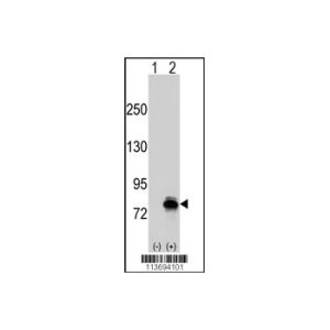 CDH6