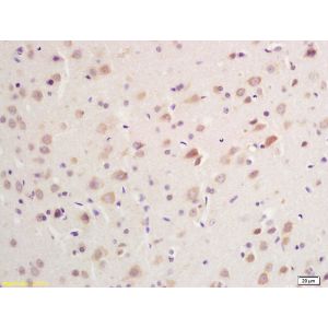 Rat brain