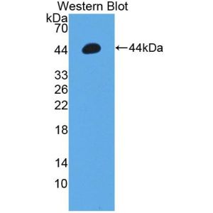Gastrin