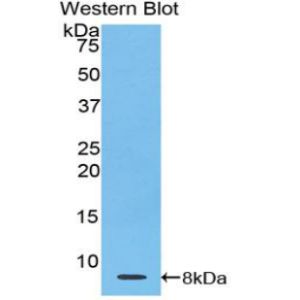 Thymosin beta-4