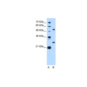 Human HepG2