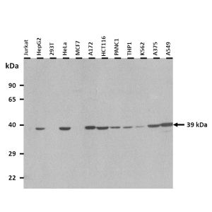 Western Blot