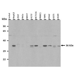 Western Blot