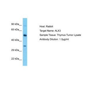Human Thymus Tumor