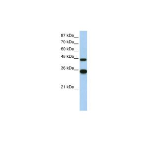 Transfected 293T 