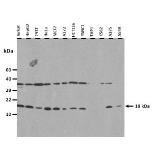 Western Blot