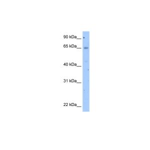 Transfected 293T