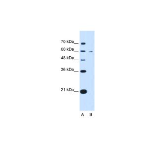 Human HepG2