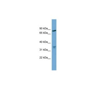 Human NCI-H226